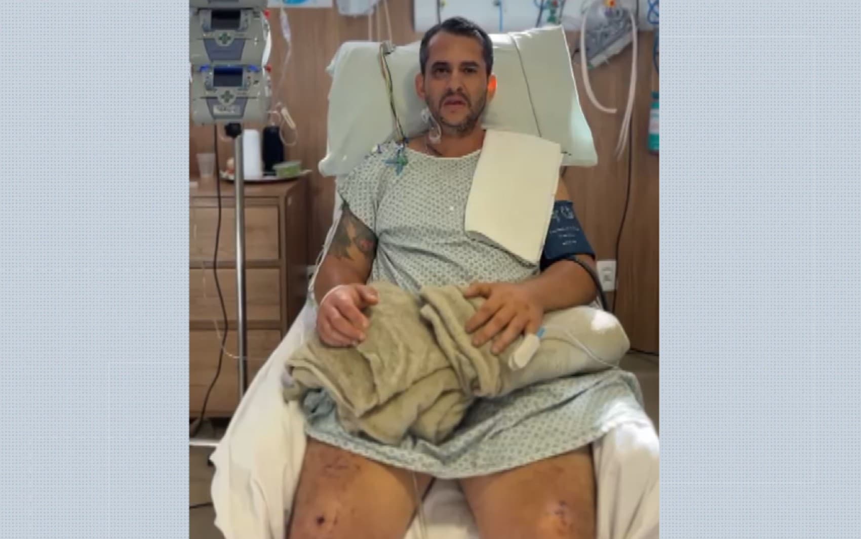 Motociclista ferido sobrevive a 2 dias em mata após acidente e é salvo por ciclista no interior de SP