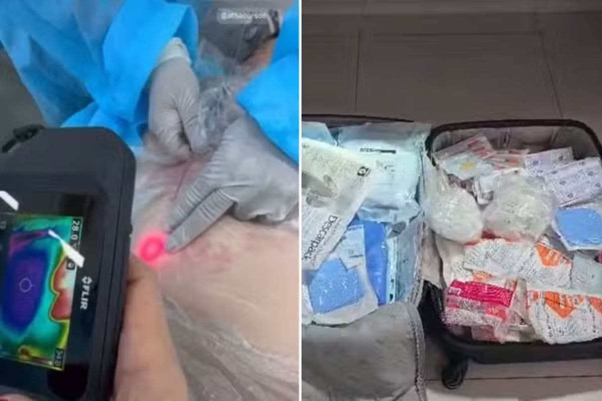 Esteticista presa em clínica clandestina é solta após pagar fiança no litoral de SP
