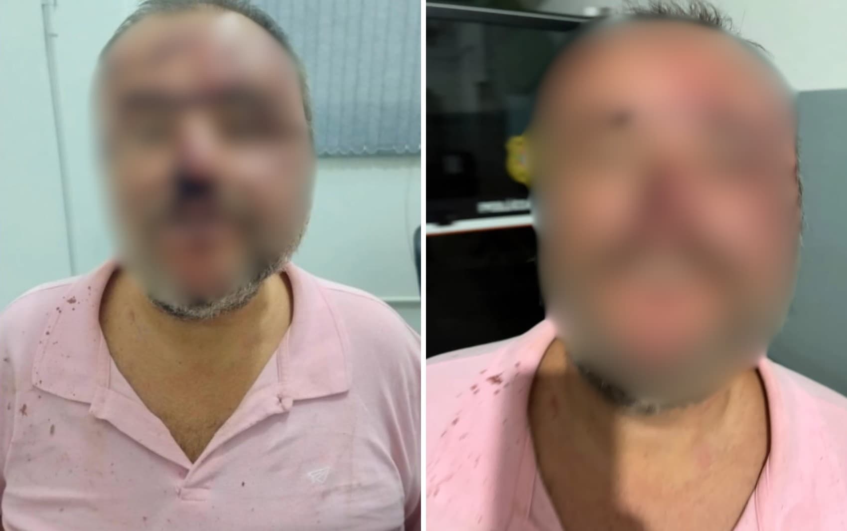 Advogado agredido por PMs diz que mostrou carteira digital da OAB, mas tenente não acreditou: 'Falou que era IA'