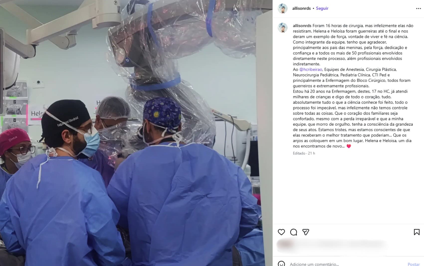 ‘Tudo o que a ciência conhece foi feito’, diz enfermeiro após morte de gêmeas unidas pela cabeça em cirurgia de separação no interior de SP